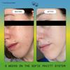 SOFIE PAVITT FACE The Skin School Set: Cleanse, Treat & Hydrate Minis for Clearer Skin view 3