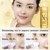 VC Toner Korean, 500 ml (17.6 fl oz)- Kniyea VC Toner Intensive , Hydrating with Hyaluronic & Centella Asiatica Minimizes Pores & Soothes Dry (500ml x 2) view 4
