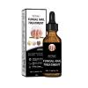 Natural Fungal Nail Treatment Oil, 30ml, Repairs Nail Discoloration and Thickness, with Application Instructions view 1