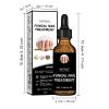 Natural Fungal Nail Treatment Oil, 30ml, Repairs Nail Discoloration and Thickness, with Application Instructions view 2