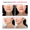 Aalok Ultra Olla | at-Home RF & LED Facial Device for Lifting, Anti-Aging Routine view 3