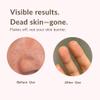 aplin Pink Tea Tree Cleansing Oil, Oil Cleanser for Face, Makeup Blackhead Remover, Korean Skin Care 6.76 fl oz(200ml) view 3