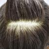 Hair Wonders Mens Toupee Human Hair Replacement System for Men Fine Mono Mens Toupee Hairpiece Durable NPU Man Hair Pieces Units Male Wigs7''X10''-120% Density 240# DARKEST BROWN+40% GREY view 3
