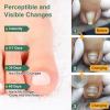Dual Nitinol Ingrown Toenail Corrector,Ingrown Toenail Treatment,Curved Toenail Straightener,Ingrown Toenail Removal Kit,Big Toe Ingrown Toenail Tool (0.55in,0.66in) view 3