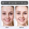 TURAOHU 800 Stickers Black Star Pimple Patches Set, Hydrocolloid Acne Patches for Face, Self-Adhesive and Tear-Off Invisible Design, Absorbs Secretions, Contains Tea Tree and Centella Asiatica Oil view 3