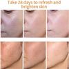 Melanina Anti-Melasma & Dark Kit, Anti-Melasma Serum+Collagen Jelly Cream, Ultra Moisturizer for Women, Supports Even Skin Tone & Radiance (SET) view 3