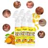 AILKE Brightening Foaming Facial Cleanser, With Natural Turmeric, Kojic Acid, Remove Makeup Residue and Acne, Clean Skin,160 ml (Pack of 1) view 3