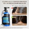 99% Pure Biotin Shampoo for 3X Thicker, Fuller Hair Growth, 80% Less Hair Loss w/Thuja Extract, Batana & Noni Fruit Oil Hair Care for Deep Nourishing,Rosemary Dandruff Treatment for Men Women,11.83oz view 4