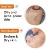 B'ody Acne Spray For Acne on Back, Shoulders, Neck & Chest | Body Acne Spray to improve Breakouts & Uneven skin texture for Women & Men - 50ml view 3
