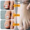 9pcs Ingrown Toenail Corrector Kits, 3 Sizes 9 Titanium Alloy Strips 10 Auxiliary Stickers 1 Nail File Practical Tools for Curved Nail Repair Straightener Brace view 3