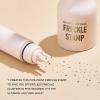 ARCHIDATE Freckle Stamp Pen, Upgraded Liquid Fake Freckle Marker with Multi-Prong Precision Stamp Head, Waterproof, Long-Lasting, Quick Dry Faux Freckles Stamp for Natural Sun-Kissed Look (MEDIUM) view 3