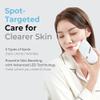 Aalok Snowfit | Red Blue Green LED Light Facial Theraphy, 3in1 Spot Targeted Home Skincare for Firming, Clear Skin, Even Tone view 2