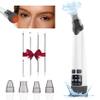Blackhead Remover Pore Vacuum - Facial Pore Cleaner with 3 Adjustable Suction Levels, 4 Blackhead Removal Tools, Electric Acne Extractor Tool for Women & Men view 1