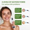 Blackhead Remover Pore Vacuum - Facial Pore Cleaner with 3 Adjustable Suction Levels, 4 Blackhead Removal Tools, Electric Acne Extractor Tool for Women & Men view 2