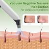 Blackhead Remover Pore Vacuum - Facial Pore Cleaner with 3 Adjustable Suction Levels, 4 Blackhead Removal Tools, Electric Acne Extractor Tool for Women & Men view 4