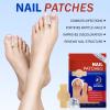 Nail Patches, 21 Pcs Toenail Care Patches Overnight Nail Care, Support the Appearance of Dry, Rough, & Brittle Toenails, Moisturizing Dry Nails for Men and Women view 2