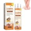 FungiBee Advanced Nail Repair Spray, Professional Bee Venom Nail Soothing Spray, nail Repair for Damaged Nails, Nails Care, Nails Repair Essence Serum for Damaged Nails Safely and Gently (1PC) view 1