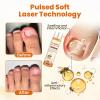 FungiBee Advanced Nail Repair Spray, Professional Bee Venom Nail Soothing Spray, nail Repair for Damaged Nails, Nails Care, Nails Repair Essence Serum for Damaged Nails Safely and Gently (1PC) view 3