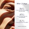 Intuisse NAD+ Eye Serum Anti Aging Under Eye Serum for Dark Circles view 4