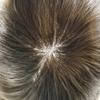 SINGA HAIR Fine Mono Toupee for Men Hairpiece Real Human Hair Lace Front Mens Toupee Hair Replacement System for Men Hairpieces Bleached Knot #6 Light Brown 8X10 120% Density view 3