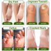 Epsom Salt Foot Soak, 10Pack Tea Tree Oil and Lavender Oil Epsom Salts for Soaking, Dead Sea Salt Spa Pedicure Care Softens Thick Calluses & Corns, Athletes Foot, with feet scrubber view 4
