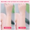 Face Threading Tool, Electric Cordless Threading Hair Removal, Portable USB Rechargeable Beauty Hair Remover, Epilators view 4