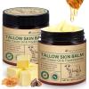 Alstaky Beef Tallow Skin Care with Castor Oi & Frankincenses, Grass Fed Whipped Tallow Honey Balm for Face & Body, Natural Moisturizer Hydrates, Deeply Nourishes, Enhances Natural Radiance view 1