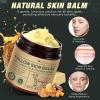 Alstaky Beef Tallow Skin Care with Castor Oi & Frankincenses, Grass Fed Whipped Tallow Honey Balm for Face & Body, Natural Moisturizer Hydrates, Deeply Nourishes, Enhances Natural Radiance view 2