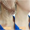 Neck Lift Tape Tightening Tape - Neck Tape Lifting Invisible view 2