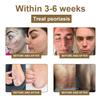 Bee Venom Treatment Spray - Remove Spots for Men Women,Bee venom fading spray, bee venom skin spray, for all parts of the body. (2) view 2