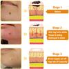 Bee Venom Treatment Spray - Remove Spots for Men Women,Bee venom fading spray, bee venom skin spray, for all parts of the body. (2) view 3