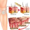Bee Venom Treatment Spray - Remove Spots for Men Women,Bee venom fading spray, bee venom skin spray, for all parts of the body. (2) view 4