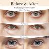 AURAE Variety Under Eye Patches (30 Pairs) - For Dark Circles & Puffiness - Eye Mask for Care view 4