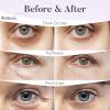 AURAE Retinol & Collagen Under Eye Patches (30 Pairs) - For Dark Circles & Puffy Eyes - Eye Care Mask view 4