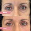 Glov Beauty - Hydrate & Brighten Eye Cream - Anti-Aging Under Eye Cream for Dark Circles, Wrinkles & Puffiness - With Retinyl Palmitate, Sodium Hyaluronate & Niacinamide - All Skin Types view 2