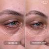 Glov Beauty - Hydrate & Brighten Eye Cream - Anti-Aging Under Eye Cream for Dark Circles, Wrinkles & Puffiness - With Retinyl Palmitate, Sodium Hyaluronate & Niacinamide - All Skin Types view 4