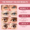 AOAO Brightening Niacinamide & Vitamin C Under Eye Masks with Alpha-Arbutin, Anti-Dark Circle & Hydrating Gel Patches, Depuff & Revitalize Eye Care, 60Pcs view 3
