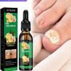 Nail Care Serum | Nourishing Oil for Weak & Brittle Nails | Fast-Absorbing Treatment(2 stick) view 3
