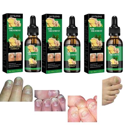 Nail Care Serum | Nourishing Oil for Weak & Brittle Nails | Fast-Absorbing Treatment (3stick)