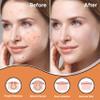 BitMark Care Pimple Patches for face | Hydrocolloid Pimple Patches with Case Mirror  Invisible Acne Patches for covering pimples, Zits & Blemishes | Acne stickers for All Skin (42 Count) view 2