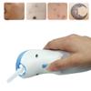 Acne Removal Treatment Device Anti-Aging Face Massager for Face Tightening Refreshing Firming Wrinkles Reduction view 3