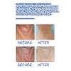 ACSUSS Anti Aging Neck Cream for Women 20 Gram Hydrating Firming Treatment Lifts Tightens Brightens Skin Texture Lightweight Non Greasy White One Size view 4