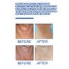 Linjinx Lifting Neck Cream for Women 20 Gram Hydrating Moisturizer Firms Tightens Smooths Fine Lines Improves Skin Tone Lightweight Formula White One Size view 4