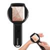 Handheld Dermatoscope, 500X Magnification Skin & Scalp Analyzer for Scalp/Hair Trichomes Facial Skin Dermatoscope, 16MP Camera for Hair Follicle Observation, Digital Microscope with 2.8" Screen view 1