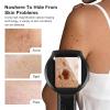 Handheld Dermatoscope, 500X Magnification Skin & Scalp Analyzer for Scalp/Hair Trichomes Facial Skin Dermatoscope, 16MP Camera for Hair Follicle Observation, Digital Microscope with 2.8" Screen view 2