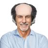 Zonfer Bald Head Wigs Bald Cap with Hairs Balding Wig Hat Old Man Wig Headwear for Halloween Carnival Cosplay Costume Parties Fancy Dress view 2