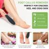 10 Pack Foot File,Foot Callus Remover Professional Sandpaper Pedicure Tools, Double Side Foot Scrubber, Sander for Dead Skin Foot Rasp Pedicure for Women Mother Manicure Beauty Shop Spa view 2