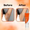 Underarm Whitening Cream for Women, Armpit Whitening Cream Natural with Kojic Acid & Vitamin B3 20g view 2