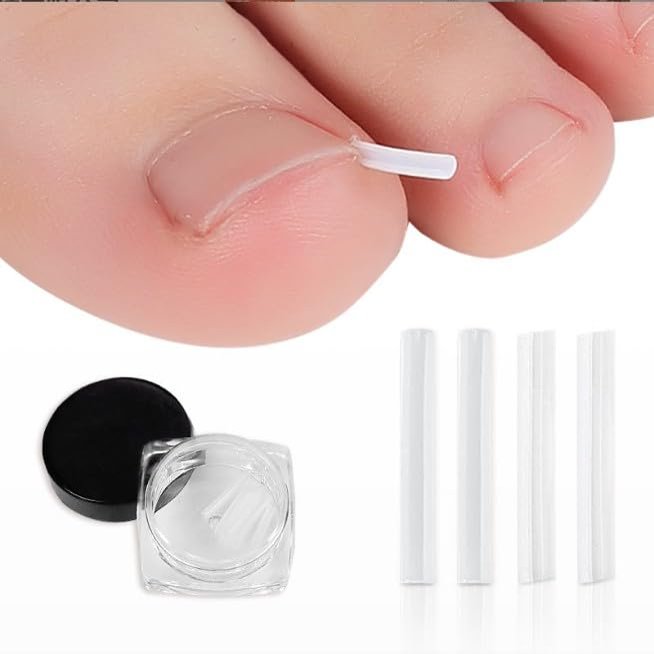 10 Pcs Ingrown Toenail Correction Strips Brace Kit, Ingrown Toenail Corrector Straightener Strips Recover Clips Toenails Thick Pedicure Tool Toenail Straightener Strip for Men Women Foot Care Tool Gr