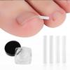 10 Pcs Ingrown Toenail Correction Strips Brace Kit, Ingrown Toenail Corrector Straightener Strips Recover Clips Toenails Thick Pedicure Tool Toenail Straightener Strip for Men Women Foot Care Tool Gr view 1